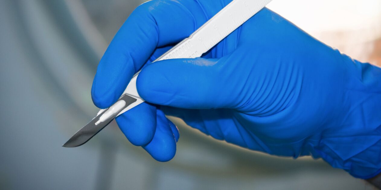 bisturí para agrandar el pene quirúrgicamente